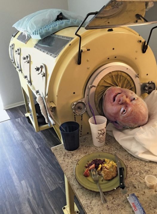 Man Who Spent 70 Years In Iron Lung Passes Away