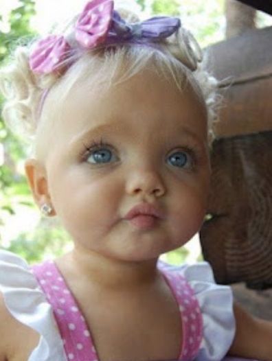 Girl Labeled ‘Real-Life Doll’ At 2-Years-Old, Wait Until You See What She Looks Like Now