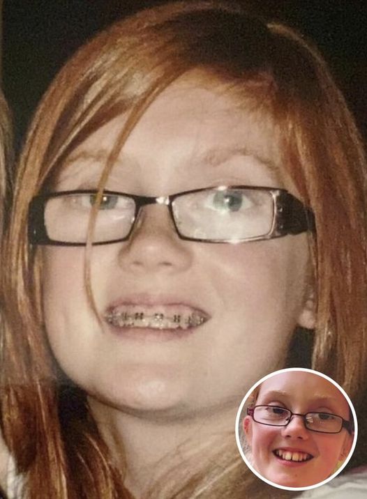 Young Girl Was Bullied For Her Red Hair, How She Looks Now Will Make You Do A Doubletake