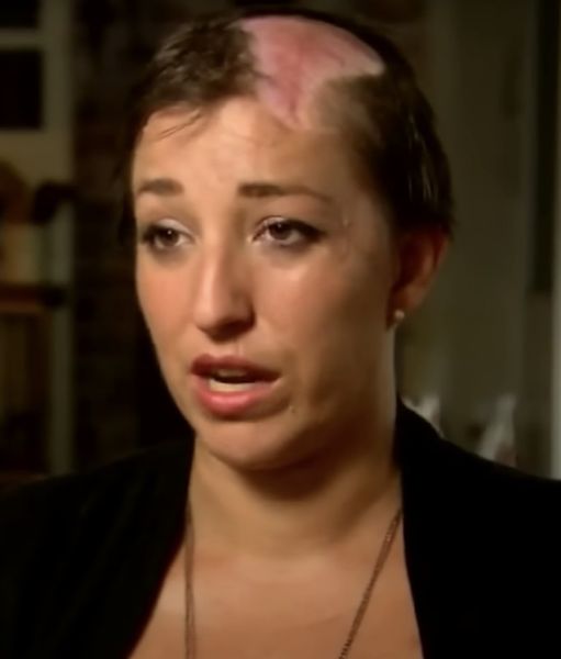 Mom Of 4 Scalped Seconds After Making Simple Mistake, Sends Warning To All Other Women