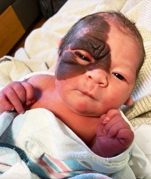 Parents Stunned When They See Newborn Daughter For The First Time, But Here’s What She Looks Like Now