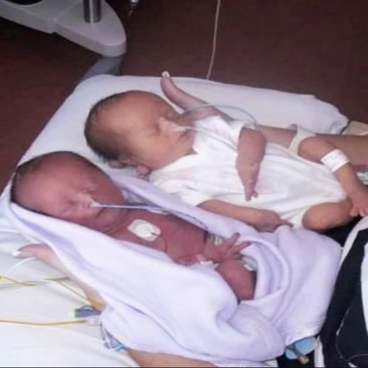 Couple expects identical twins, freeze when the doctor says ”I’m sorry”.