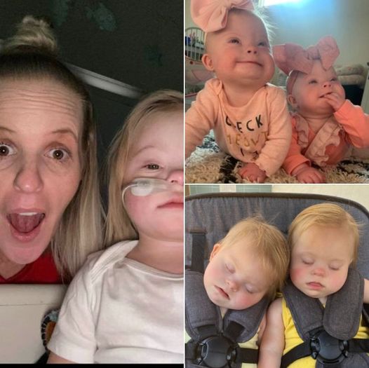 “I wouldn’t want those babies” 😭 one, cruel troll said. “If my babies were born like that, they’d be put up for adoption,” another told the girls’ mother. Fortunately, this brave mom had the ideal response to critics of her beautiful twins.