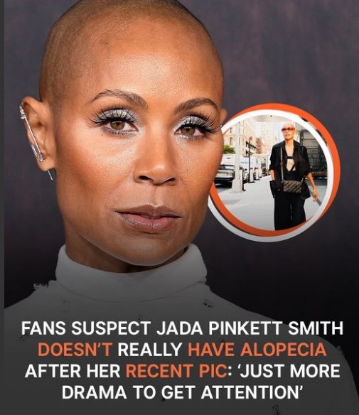 Fans Suspect Jada Pinkett Smith Has No Alopecia after Her Recent Pic: ‘Just More Drama to Get Attention’.