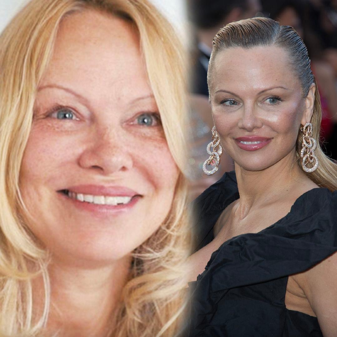 Pamela Anderson refuses to do anything “crazy” to prevent her aging and the latest photos of her confirm what we all knew.