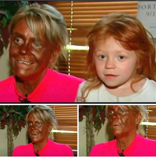 Mom obsessed with tanning looks totally unrecognizable today.