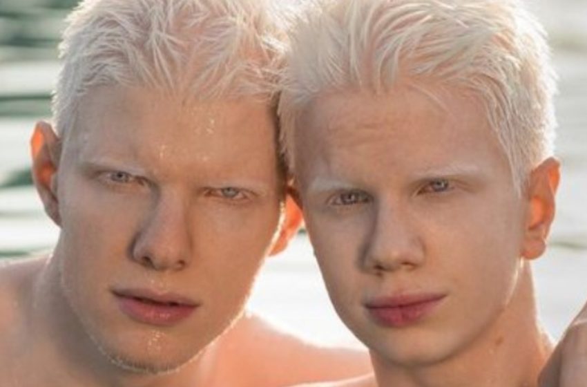 What Does The Mother of These Albino Siblings Look Like?: “Unusual Family”