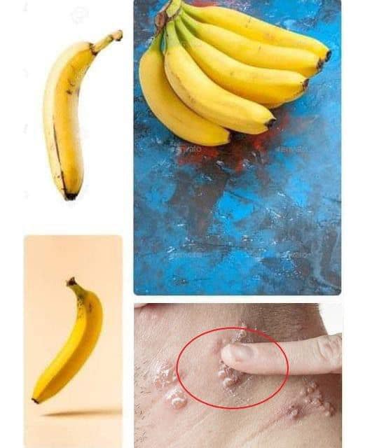 Did you know that if you eat BANANA EVERY DAY your body can…