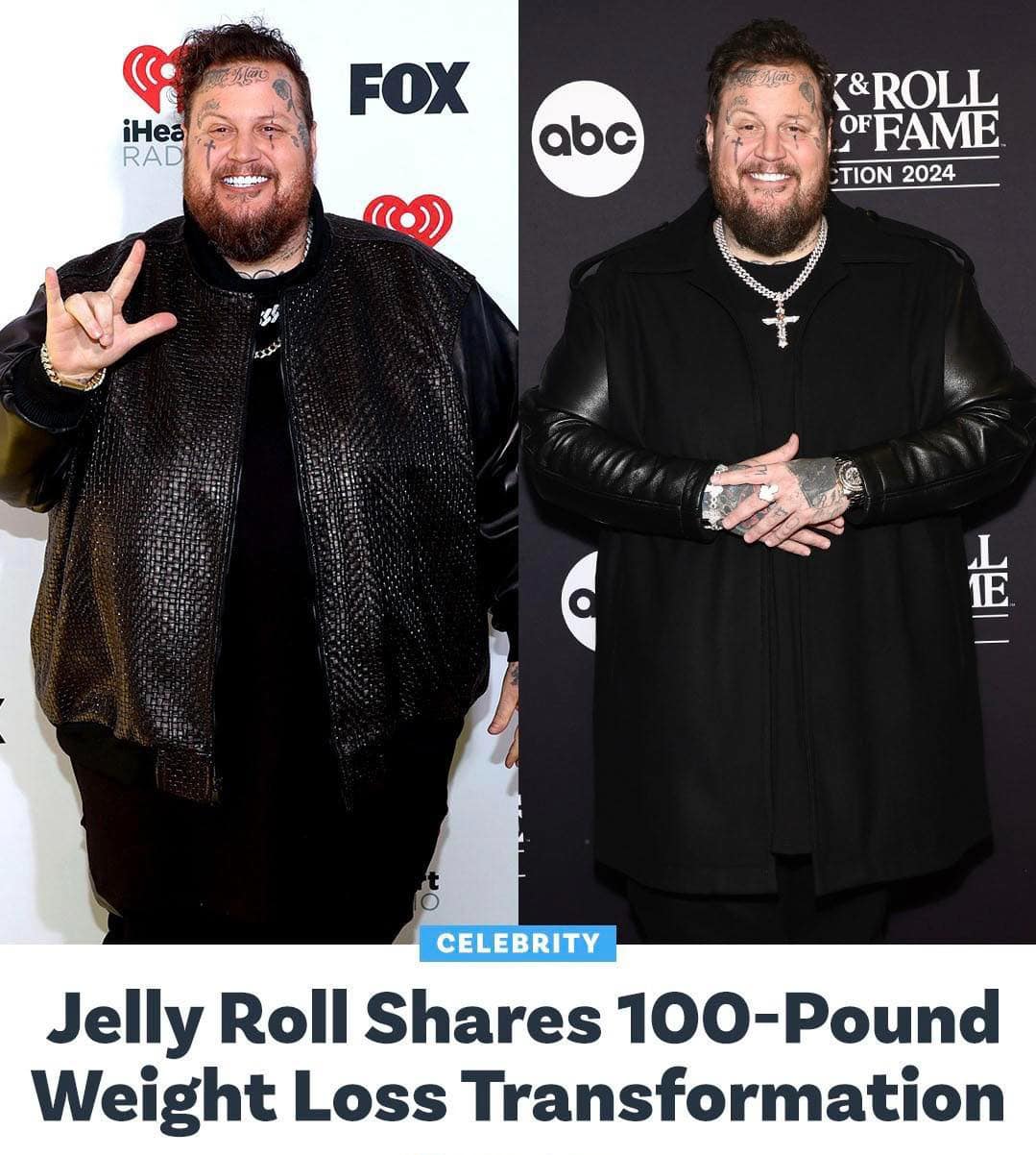 JellyRoll has lost 100 pounds!💪🔥 The country star just revealed details of his weight loss transformation amid his Beautifully Broken tour, joking in a video that next year when fans see him, “you won’t recognize me.” More in the comments on the “Wild Ones” singer’s health journey. ⬇️