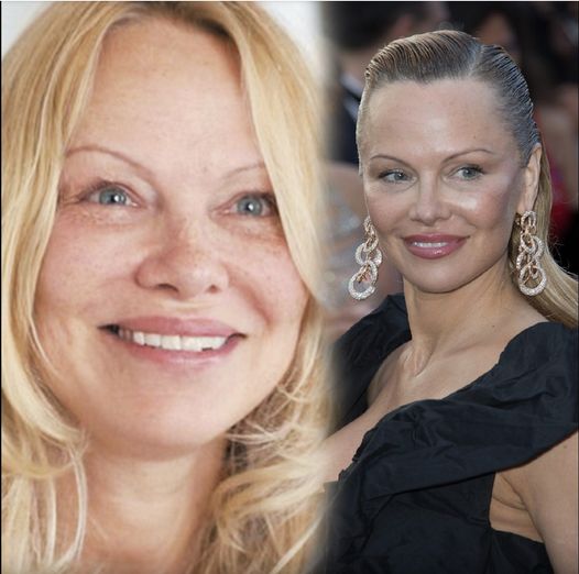 Pamela Anderson refuses to do anything “crazy” to prevent her aging and the latest photos of her confirm what we all knew…