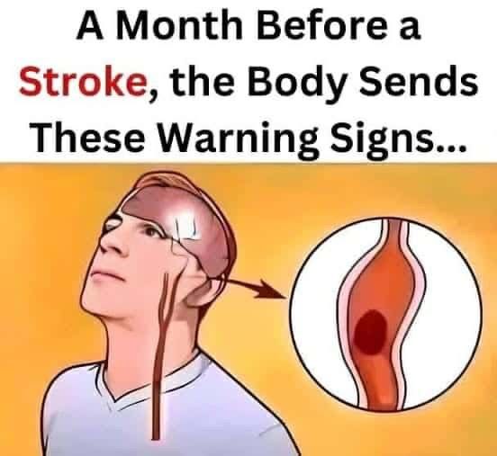 😱 Attention… 🙏A Month Before a Stroke, Your Body Sends These Signals…