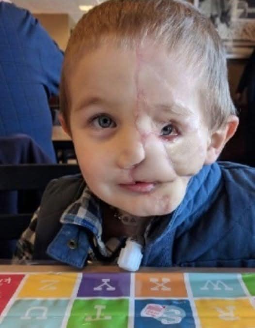 At just five years old little Ryder Wells has been through more horror than most would experience in a lifetime 😢 Please don’t move around without looking at him now in the photos in comment ❤️Full story👇👇