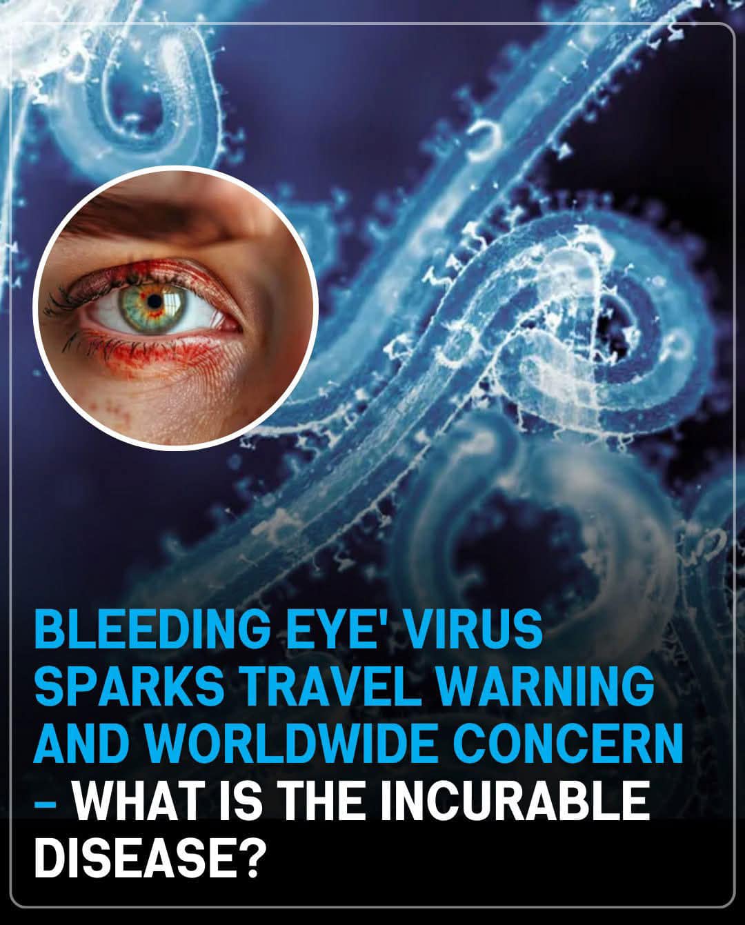 Incurable virus sparks global health concerns. 🌏👁️ Details 👇