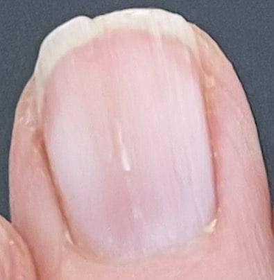 Here’s What Your Nails Say About Your Health….Check Comments..!