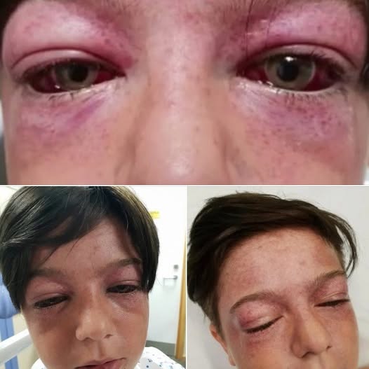 11-year-old found unconscious and ”looking like an alien”, then mom learns horrific truth and shares a warning for all parents… Check comments👇😢