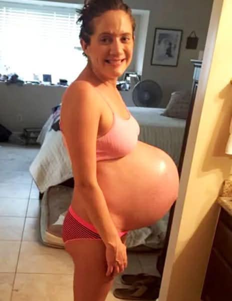 After 3 painful years of infertility, she becomes pregnant – but what’s inside her belly isn’t what people expected…/ Read below 👇👇👇