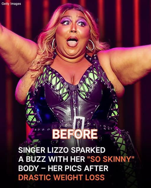 “SHE LOOKS LIKE A DIFFERENT PERSON,”🤯 one user noted. Photos of singer Lizzo before & after her TRANSFORMATION are in the comments.👇