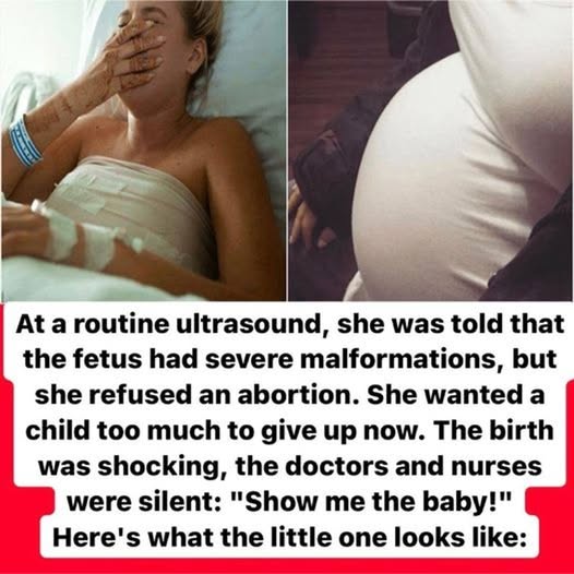 The pregnancy went normally, until, on an ultrasound, the woman was warned that she would have a baby with malformations! What happened next is incredible…. Check more details in the comments 👇👇👇